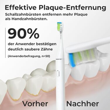 Звукова зубна щітка WhyteDOT® Premium: тиха, ефективна, з алюмінієвим корпусом, UV-футляром та до 6 тижнів роботи