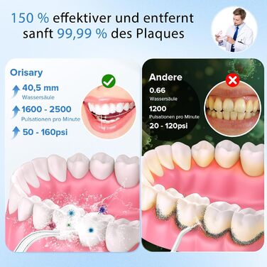 Електричний ірigator для порожнини рота Munddusche, 5 режимів, 5 насадок, 300 мл резервуар, перезаряджається, для чищення зубів та ясен, водонепроникний IPX7, чорний