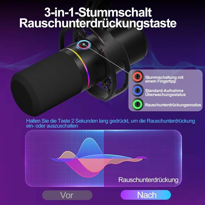 Сокодокс XLR/USB мікрофон з підставкою, мікрофон для стрімінгу з шумозаглушенням, регулятором гучності, мікрофон для подкастів, студії, геймінгу та запису